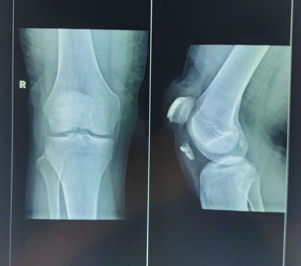 1701240233459336.jpg 1701240233459336.jpg