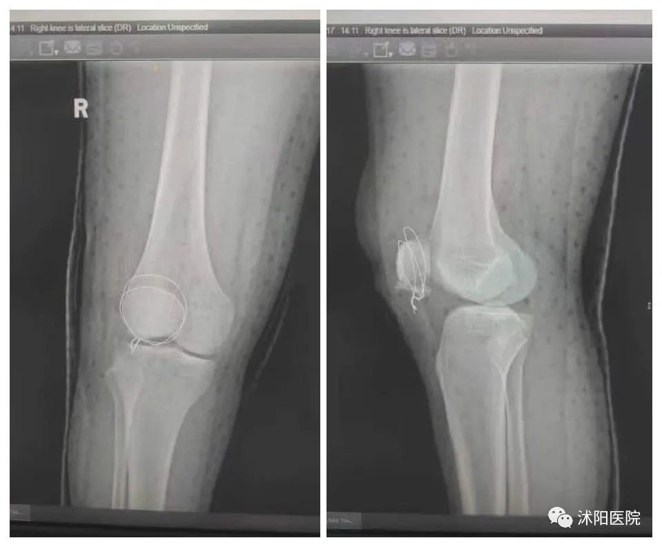 1701240316440714.jpg 1701240316440714.jpg