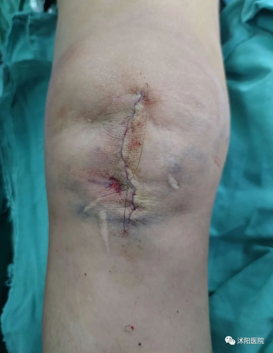 1701240379694496.jpg 1701240379694496.jpg