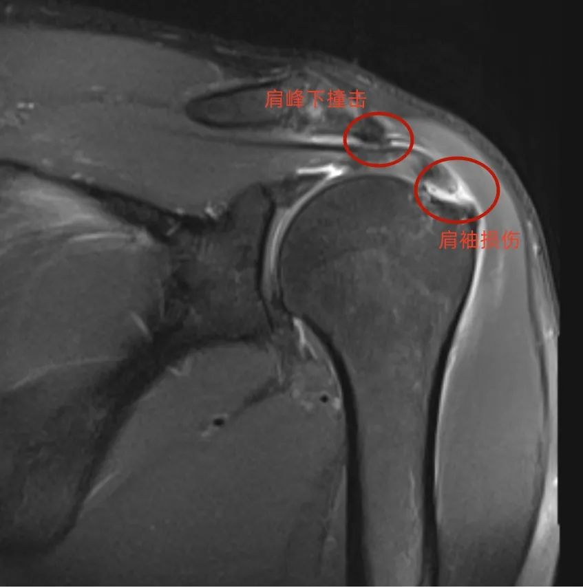 1701303585180412.jpg 1701303585180412.jpg