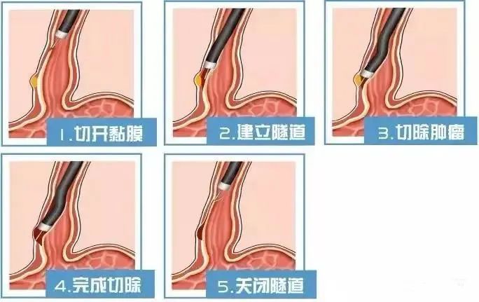 1701919162825719.jpg 640.jpg