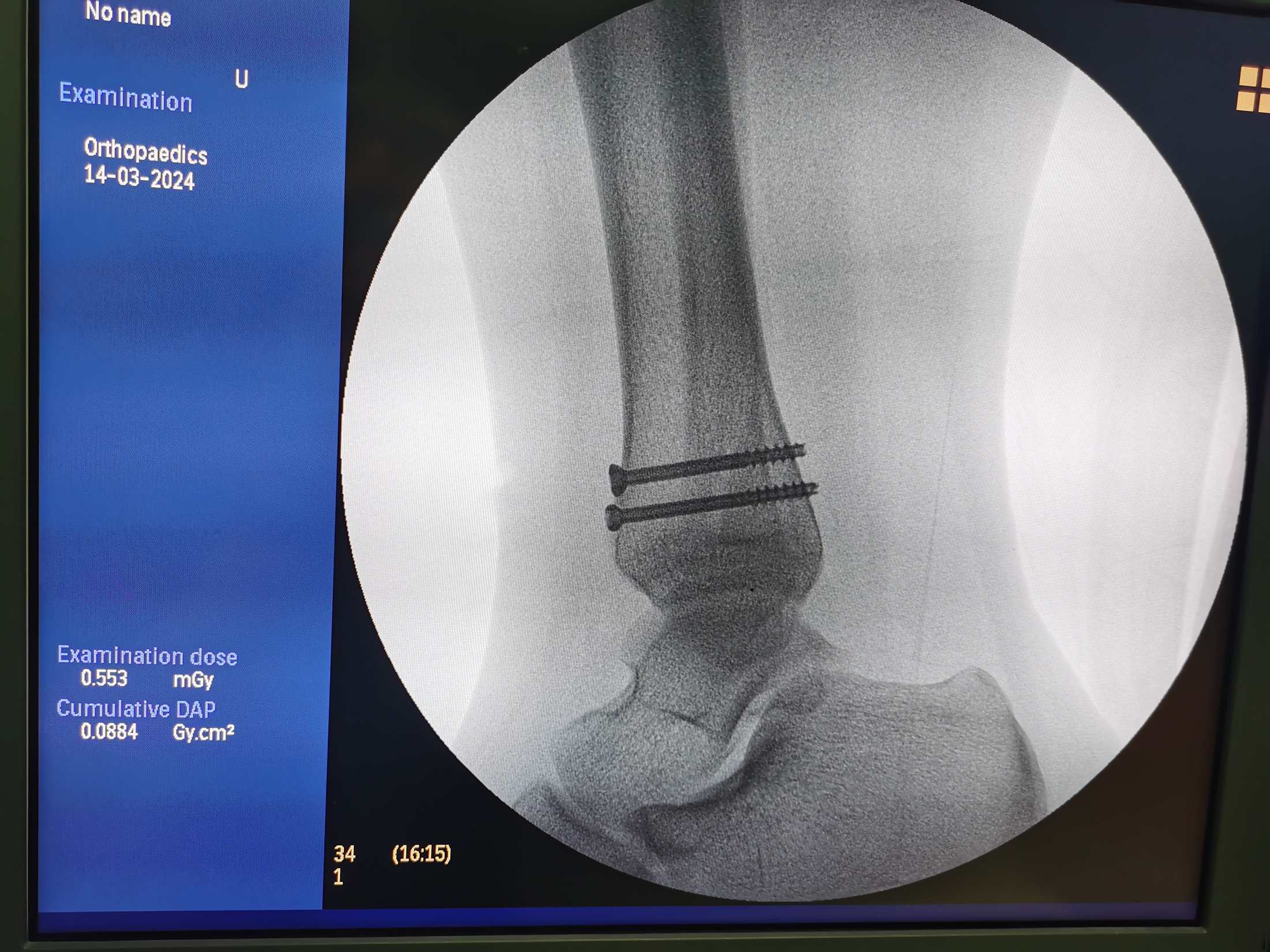 1715217290738977.jpg 1715217290738977.jpg