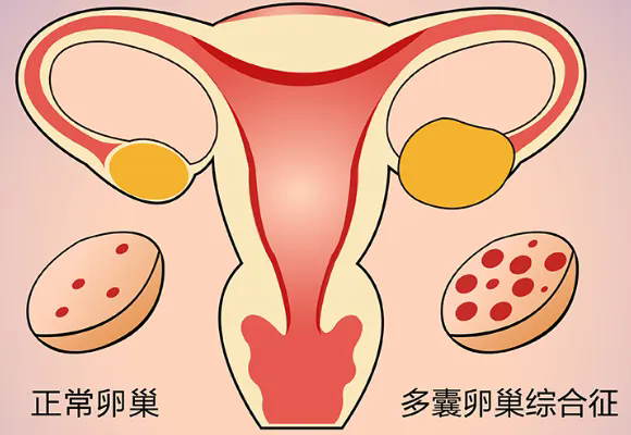 1717806163818005.png 640.webp (2).png