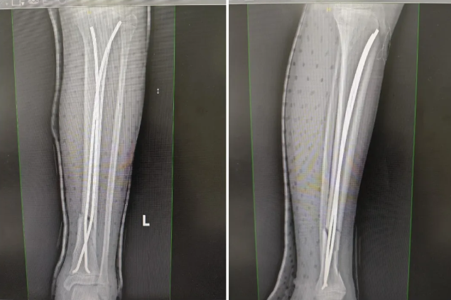 1718931538784422.png 1718931538784422.png