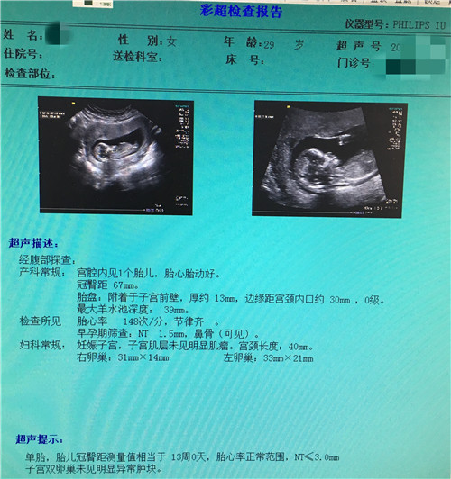 赵秀2.jpg