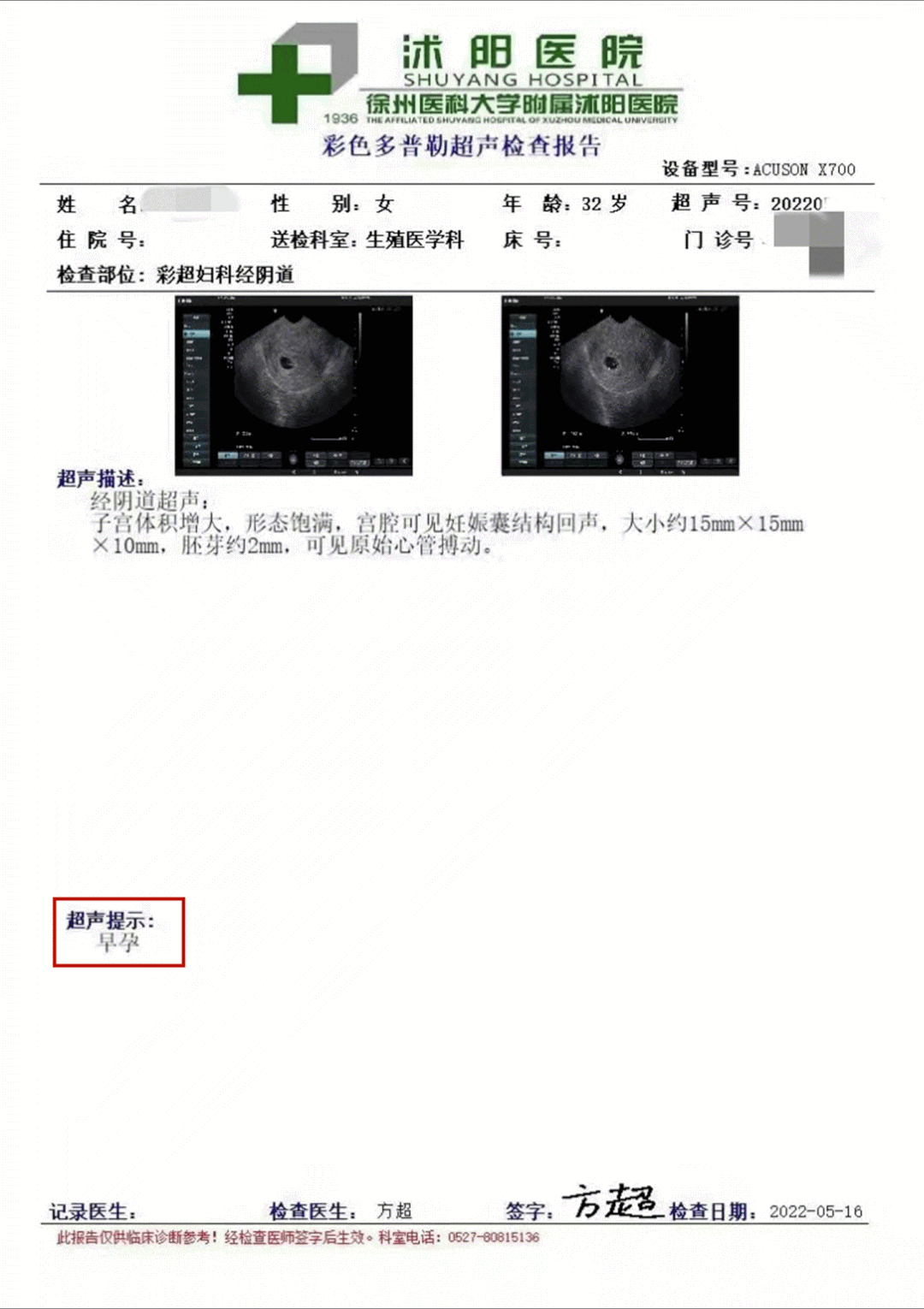 B超单.gif